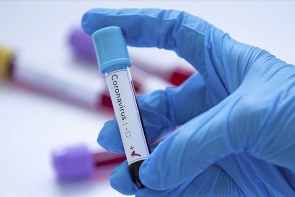 U FBiH 102 nova slučaja virusa korona