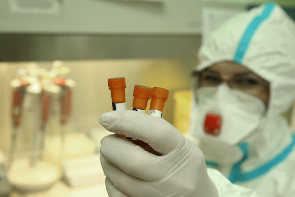 EPIDEMIJA NE JENJAVA Korona virusom zaraženo još 119 osoba u Srpskoj