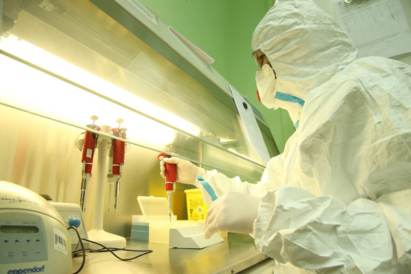 PREMINULA TRI PACIJENTA Na korona virus pozitivno još 109 osoba u Srpskoj