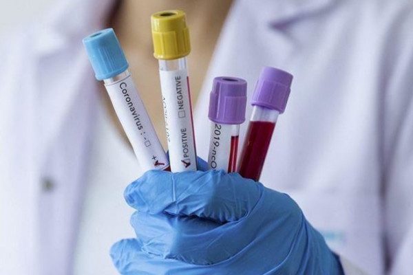 U Srpskoj na virus korona pozitivno 97 osoba