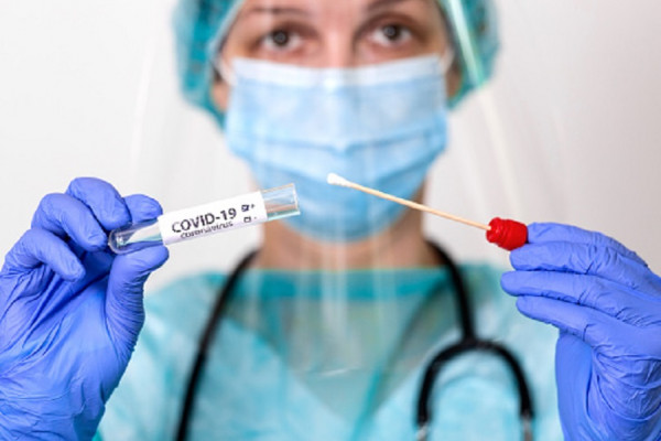 Korona virus potvrđen kod još 226 osoba u Srpskoj