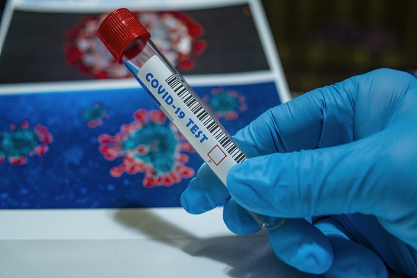 Virus korona potvrđen kod 387 оsоba u RS, 26 smrtnih slučajeva