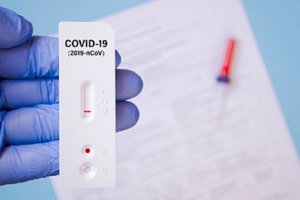 ZA 20 MINUTA DO REZULTATA Uskoro u prodaji kućni test na korona virus