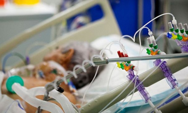 Dr Lukić ističe da mehanička ventilacija POVEĆAVA RIZIK za kardiovaskularne probleme