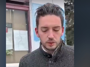 Pretučen lider PSG, Grboviću razbijena glava u blizini biračkog mjesta (VIDEO)