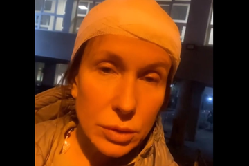 Poznata srpska voditeljka pogođena kamenom u glavu