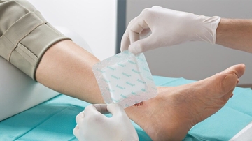 Rusi razvili sistem “pametnog” zarastanja rana