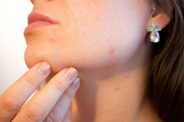 Najčešće greške u njezi kože koje sabotiraju vaš trud – i kako ih izbjeći