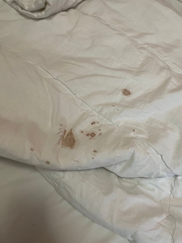 Smeće i jogurt sa isteklim rokom: Osnovci iz Banjaluke nezadovoljni uslovima u hotelu Putnik, roditelji zgroženi