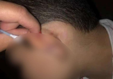 "Trpi nasilje od prvog razreda" Oglasila se majka pretučenog dječaka (8) , pa optužila i učiteljicu