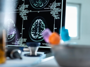 Da li korona utiče na pad inteligencije?