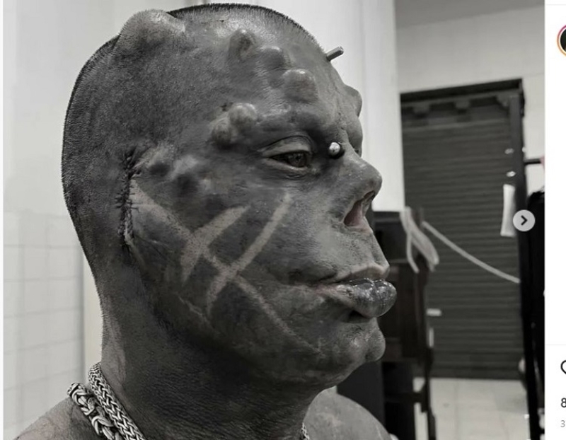 Brazilac posle ugrađivanja rogova, isjekao uši; razlog - maske protiv koronavirusa VIDEO