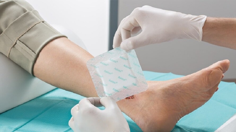 Rusi razvili sistem “pametnog” zarastanja rana